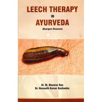 Leech Therapy in Ayurveda